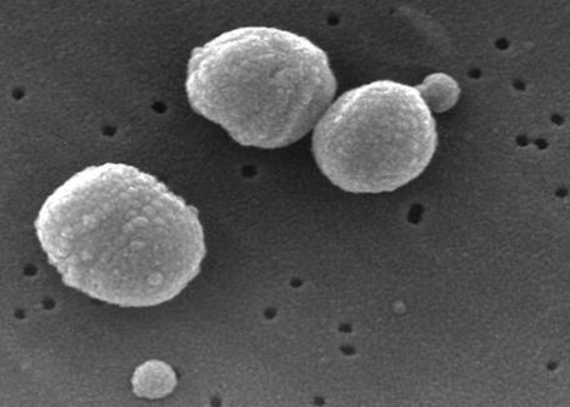 Group B Streptococcus Infections On The Rise Despite Prevention   Streptococcus Pneumoniae 1140x815 