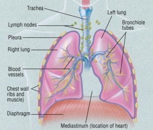 Patient Basics: Pneumonectomy | 2 Minute Medicine